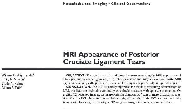 IRM du genou : MRI appearance of posterior cruciate ligament tears