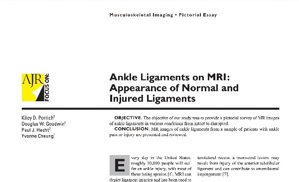 IRM de cheville : Ankle ligaments in MRI