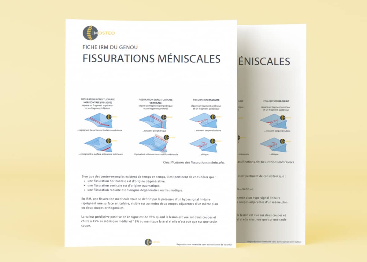 Aperçu fiche IRM genou