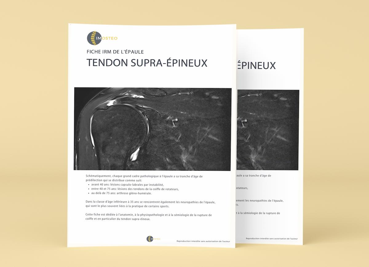 Fiche résumé IRM épaule